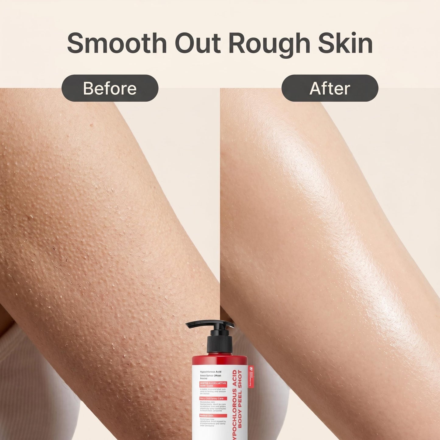 Hámlasztó testápoló | SMOOTHX
